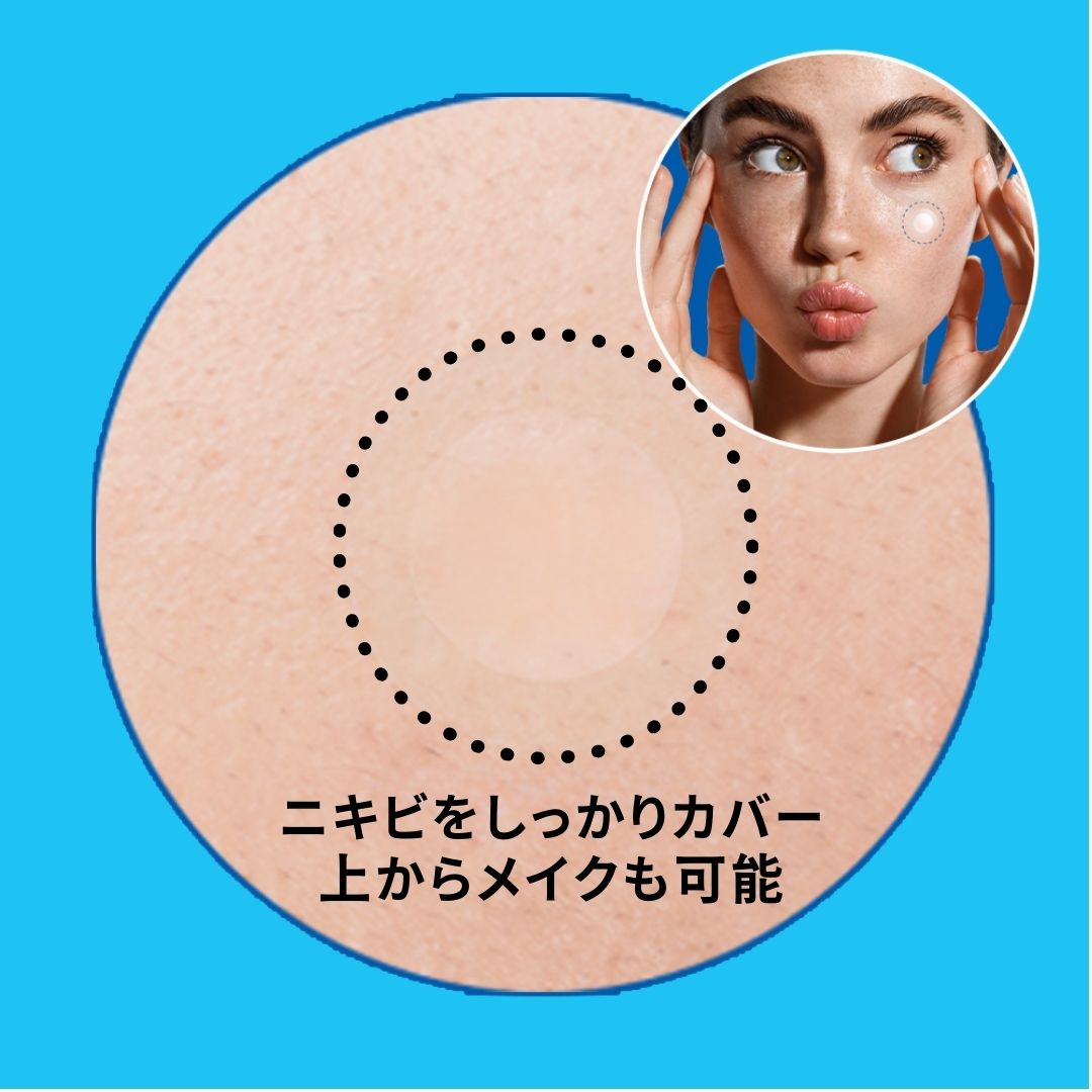 ノラアワー スポットイレイザーブルー 純度100% ハイドロコロイドパッチ 超薄型 目立たない メイクができる 63枚入り ニキビパッチ にきびパッチ