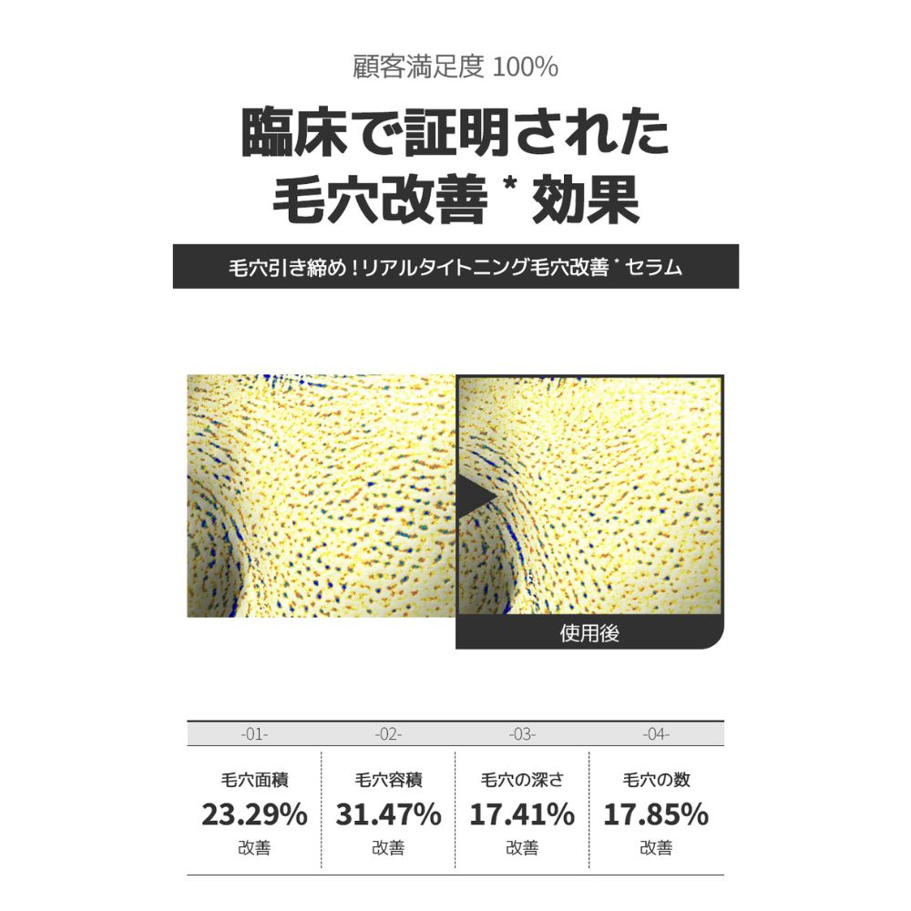 starlike スターライク ナイアシンアミド 21% ポアセラム30ml 美容液 高含量 ナイアシンアミド 21% ゼロ毛穴 毛穴 毛穴ケア 毛穴レス 黒ずみ たるみ 美容液 透明感 無着色 無香料
