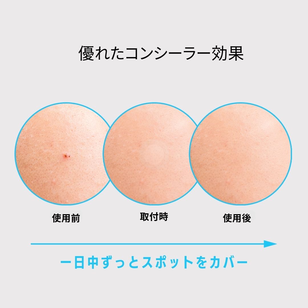 ノラアワー スポットイレイザーブルー 純度100% ハイドロコロイドパッチ 超薄型 目立たない メイクができる 63枚入り ニキビパッチ にきびパッチ