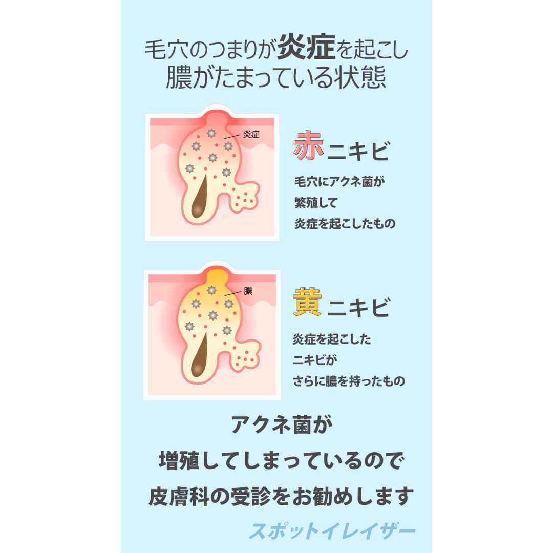 ノラアワー スポットイレイザー 3種セット(グリーン・ブルー・オレンジ)合計84枚入り(9枚+63枚+12枚) ニキビパッチ 韓国ニキビパッチ