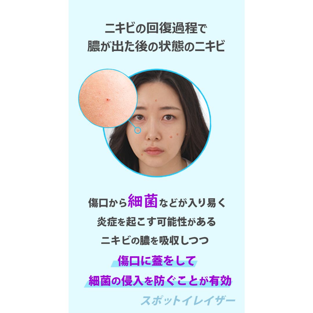 ノラアワー スポットイレイザー 3種セット(グリーン・ブルー・オレンジ)合計84枚入り(9枚+63枚+12枚) ニキビパッチ 韓国ニキビパッチ