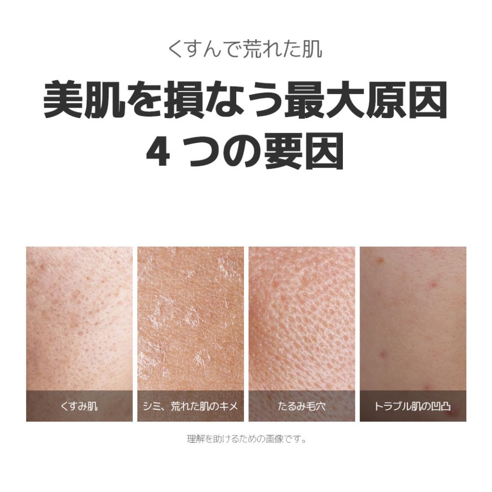 starlike スターライク ナイアシンアミド 21% ポアセラム30ml 美容液 高含量 ナイアシンアミド 21% ゼロ毛穴 毛穴 毛穴ケア 毛穴レス 黒ずみ たるみ 美容液 透明感 無着色 無香料