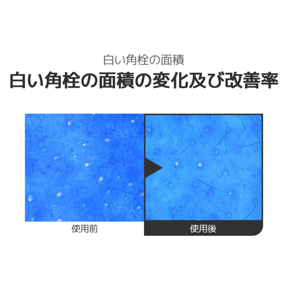 starlike スターライク ナイアシンアミド 21% ポアセラム30ml 美容液 高含量 ナイアシンアミド 21% ゼロ毛穴 毛穴 毛穴ケア 毛穴レス 黒ずみ たるみ 美容液 透明感 無着色 無香料